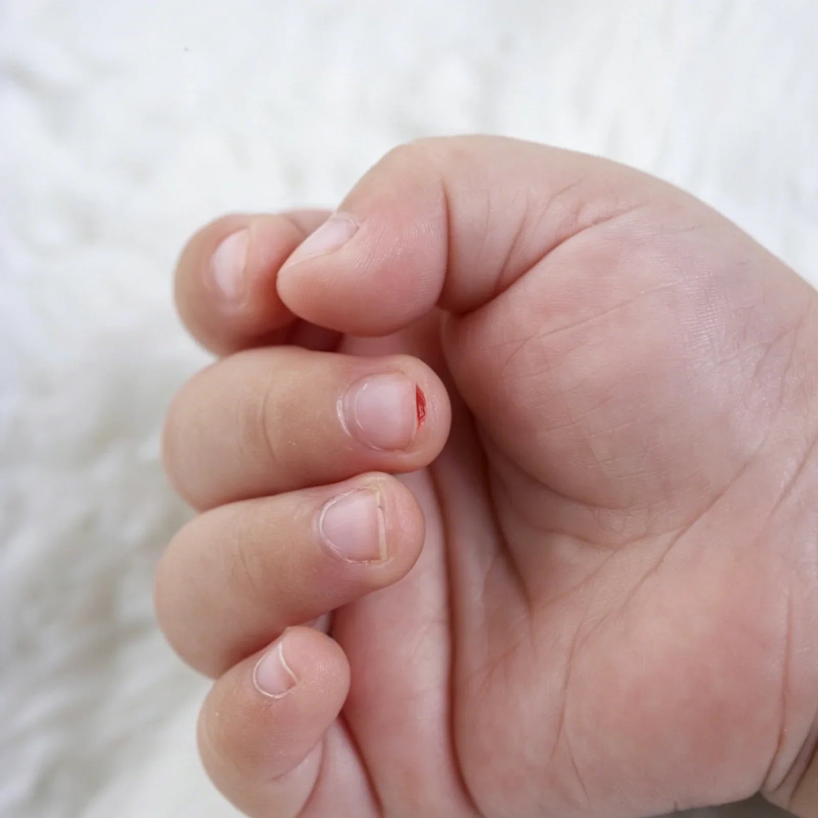 Risk of cutting fingers and nail beds when using sharp manual nail clippers on babies